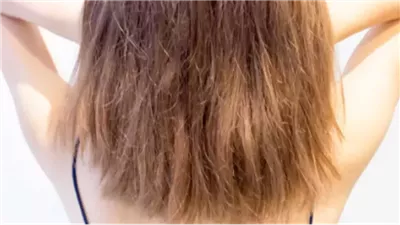 وصفة طبيعية لترطيب الشعر الجاف وإعادة جماله