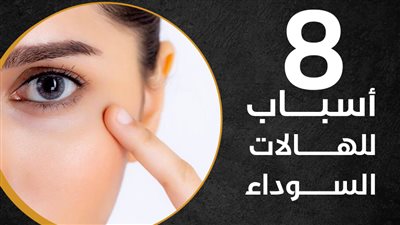 8 أسباب للهالات السوداء (انفوجراف)