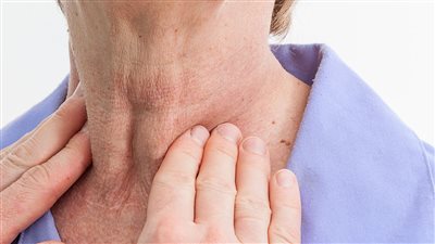  أبرزها زيادة الوزن وتساقط الشعر، أعراض قصور الغدة الدرقية 