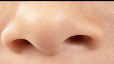 منعته من التنفس، إخراج 150 حشرة كبيرة من أنف أمريكي (فيديو)