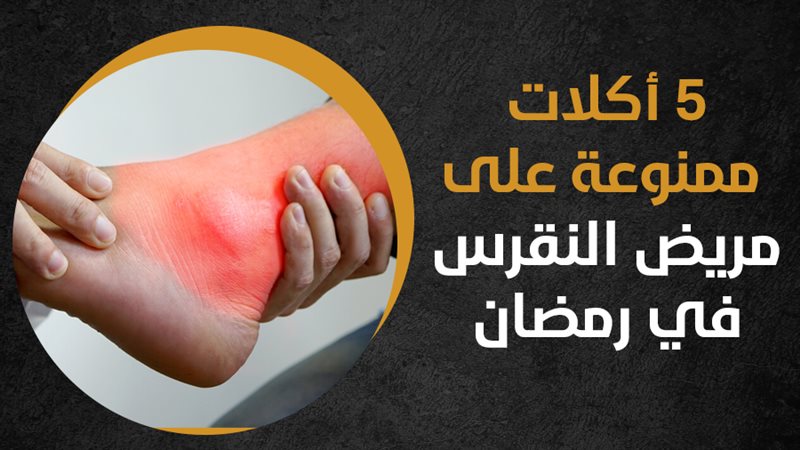 النقرس، فيتو