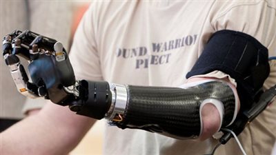 مؤسسة روسية تطور أطرافا صناعية للأطفال بمواصفات خاصة 