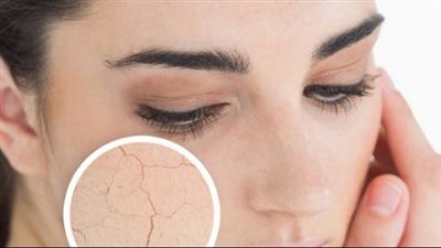 قناع البرتقال والليمون لتنظيف وترطيب البشرة الدهنية 