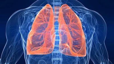 المرتبة الثانية عالميا بعدد الوفيات، هل يمكن الشفاء من مرض الالتهاب الرئوي؟ الصحة توضح