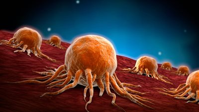  هل يصوم مريض الأورام بأمان؟ طبيب يجيب (فيديو)