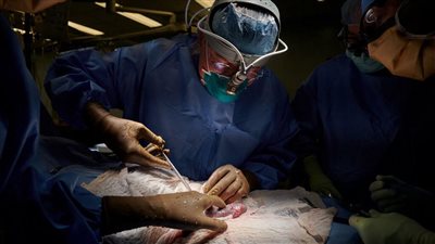 قطع غيار حيوانية لأجسام البشر.. والخنازير أكثر الكائنات المرشحة