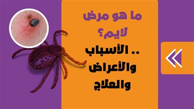 ما هو مرض لايم ؟.. الأسباب والأعراض والعلاج | إنفو جراف