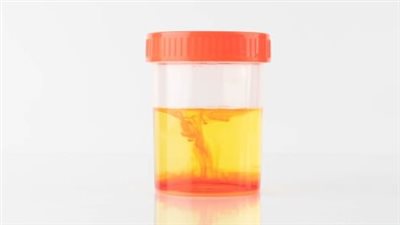  أخطرها السرطان، أهم أسباب وجود دم في البول 