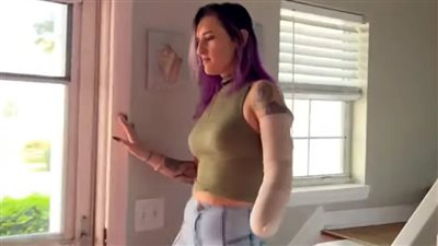 حادث غريب، سيدة تفقد يدها بسبب مجفف شعر