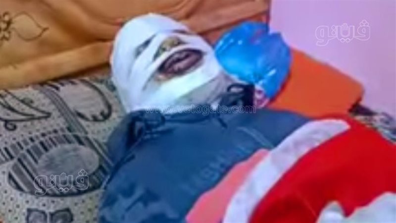 تفاصيل إصابة سائق