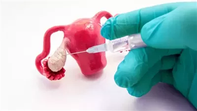  بسبب تأخر سن الزواج، الدراما التونسية تطالب بتعديل قانوني يسمح للبنات بتجميد البويضات