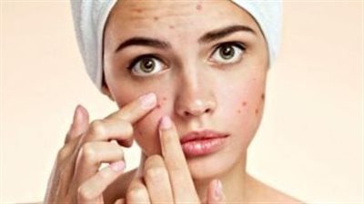 وصفة طبيعية لتنظيف وترطيب البشرة الدهنية وتعزيز نضارتها 