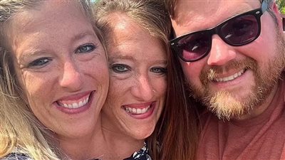 رأسان وجسد واحد، قصة زواج التوأم الملتصق الأشهر في العالم 