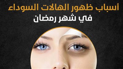  أسباب ظهور الهالات السوداء في شهر رمضان (إنفوجراف) 