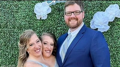 التوأم الملتصق آبي وبريتاني يوجهان رسالة بعد زفاف إحداهما 