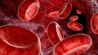 أعراضها نزيف الأنف والكدمات، ماذا تعرف عن متلازمة 