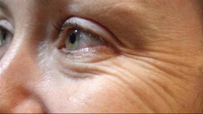 لتجنب ظهور التجاعيد، قناع طبيعي استخدميه يوميا قبل النوم لإعادة شباب البشرة