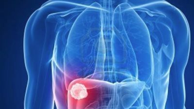 بسعر 404 جنيهات، فاكسيرا توفر تطعيم التهاب الكبدي أ بمراكز التطعيمات