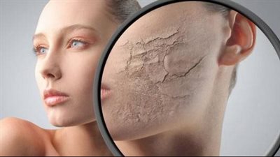 قناع الكركديه والأرز لتقشير وتوريد البشرة الجافة