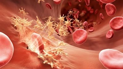 700 مليون جنيه تكلفة الخطة الوقائية لمرض الهيموفيليا على نفقة التأمين الصحي 