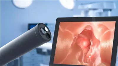 ما هو منظار القولون وأسباب إجراؤه واستخداماته