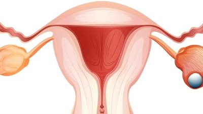 في اليوم العالمي لسرطان المبيض، 6 أعراض للإصابة أخطرها النزيف