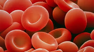 الصحة: اكتشاف 32 ألف حالة مصابة بأنيميا البحر المتوسط