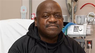 وفاة أول مريض خضع لعملية زرع كلية خنزير في العالم 