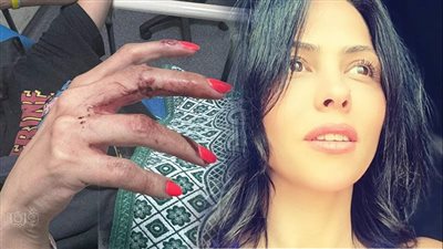 أول صور ترصد آثار تعدي سائق أوبر على فتاة التجمع