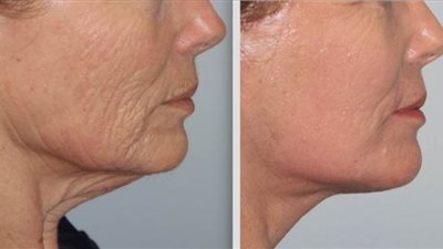 استشاري أمراض جلدية: 