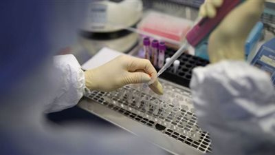 روسيا ترسل إلى 7 دول أنظمة متطورة للكشف عن فيروس كورونا