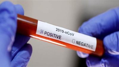 مسؤول أمريكي: اختبار أول جرعة تجريبية للقاح فيروس كورونا سريريًا اليوم