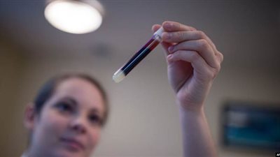 دراسة صينية تحدد أصحاب فصيلة الدم الأكثر عرضة للإصابة بفيروس كورونا