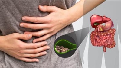 3 مضاعفات خطيرة لحصوات المرارة وعلاجها