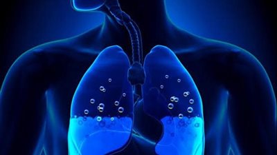 أعراض وجود مياه على الرئة 