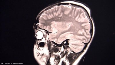 صدق أو لا تصدق.. دراسة: كورونا يصيب بـ