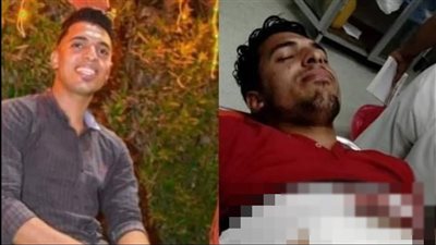 بسبب خلاف على الأجرة.. إصابة طالب بجامعة السادات في مشاجرة