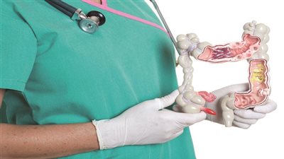 أعراض مرض كرون وأهم أسبابه