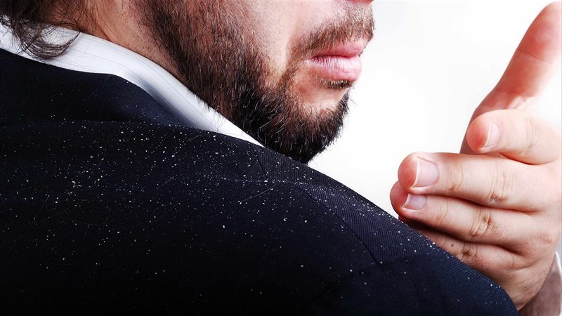 قشرة الرأس وأسبابها