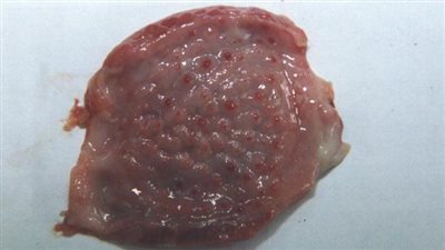  طبيب بيطري يحذر من تناول اللحوم ذات النقط النزفية