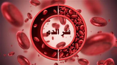 أعراض الأنيميا، وأنواعها وأفضل طرق الوقاية والعلاج