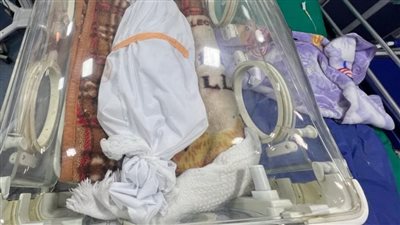 استشهاد طفلة بمستشفى كمال عدوان بسبب توقف جهاز الأكسجين