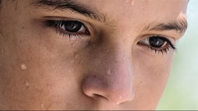 أسباب التعرق الشديد عند الأطفال وطرق التعامل معه