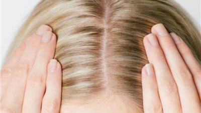 وصفة سهلة لتنظيف الشعر وعلاج تساقطه 