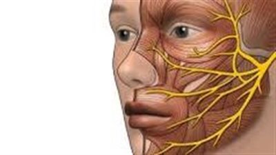  أعراض شلل العصب السابع وطرق العلاج 