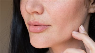 قناع العرقسوس والزبادى يحول بشرتك الجافة إلى مرآة