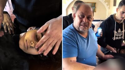 لإنقاذ حياتها، فلسطينية تروي تفاصيل بتر قدمها بسكين على طاولة مطبخ دون تخدير (صور وفيديو)