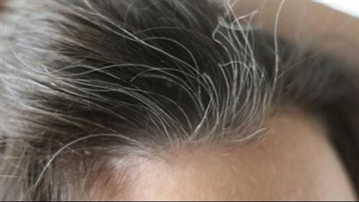 وصفة طبيعية لعلاج شيب الشعر والتساقط 