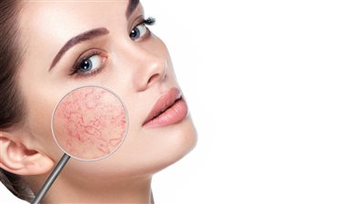 قناع الشوفان والعسل لتقشير البشرة الحساسة 