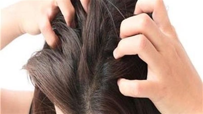 فروة الرأس، فيتو
